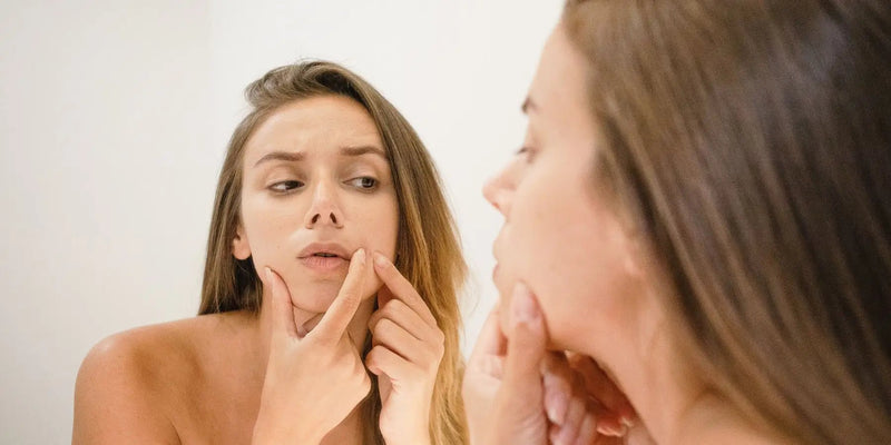 Say Goodbye to Stubborn Dark Spots with the Best Spot Corrector - Karin Herzog