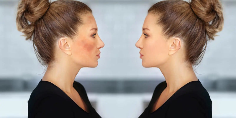 How to Effectively Fade Dark Spots with the Best Dark Spot Corrector Face Cream - Karin Herzog