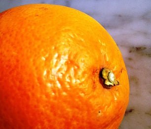 What Can We Do About Cellulite? - Karin Herzog