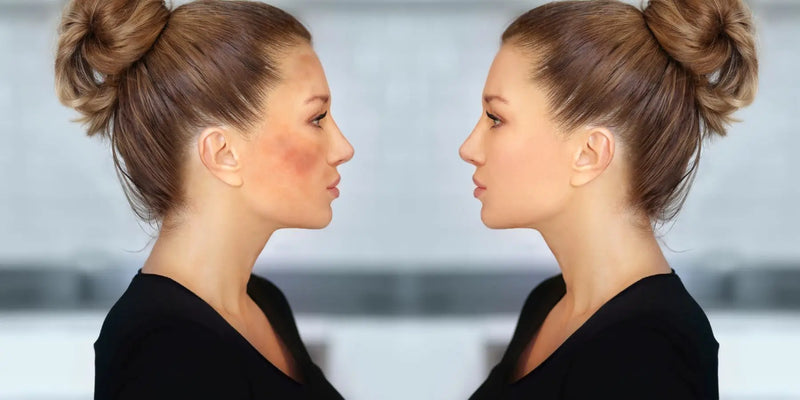 How to Effectively Fade Dark Spots with the Best Dark Spot Corrector Face Cream