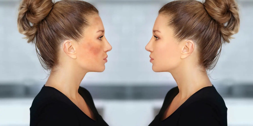 How to Effectively Fade Dark Spots with the Best Dark Spot Corrector Face Cream - Karin Herzog